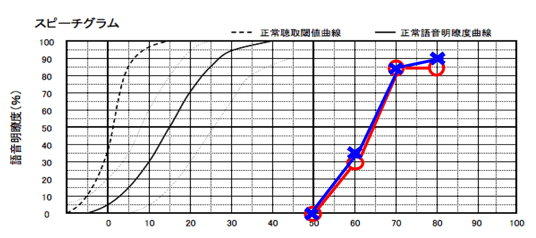 語音明瞭度を調べた時に記載する図。こちらも聴力と同じく、○が右耳、×が左耳になる。