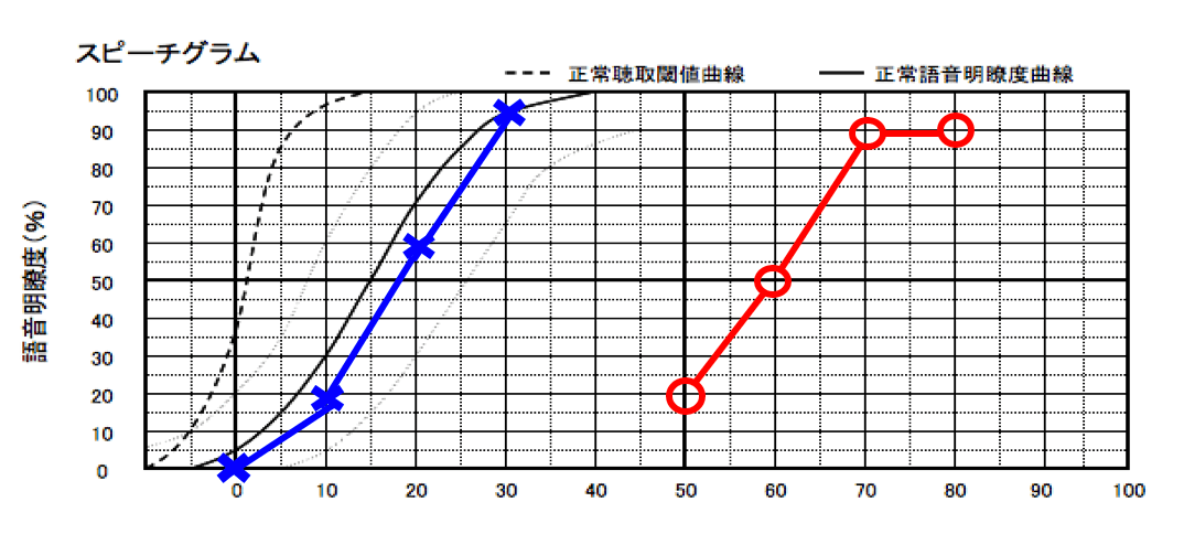 音を入れることによって理解できる耳の場合は、必ず縦軸が高くなる。