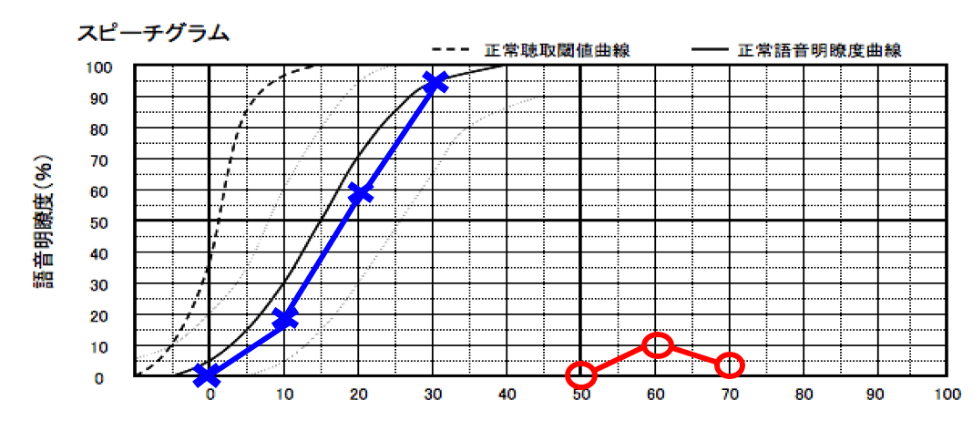音を入れたとしても、それが音声の理解につながらないケースもある。こちらがその例。音量を大きくしても思うように数値が伸びていないことがわかる。