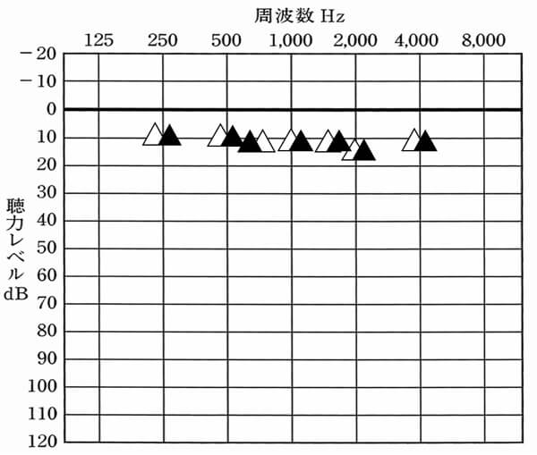 補聴器を装用した状態としていない状態で同じ位置に出れば、聞こえにくくなっていないことがわかる。