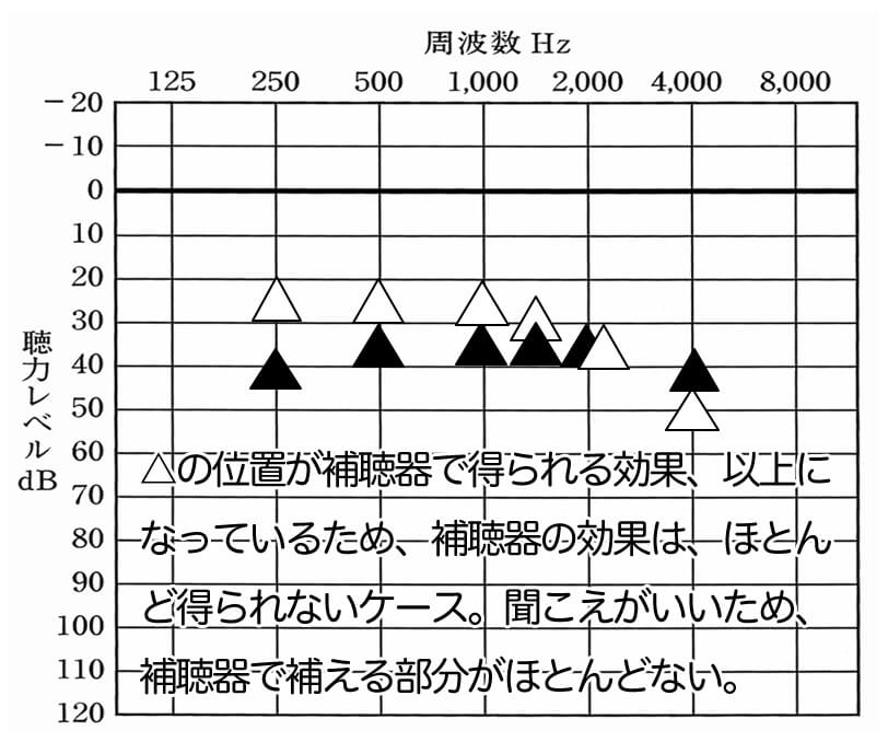 逆にこのようになるとかなり厳しい。特に、500Hz、1000Hz、1500Hzが改善値よりも上のケースは、厳しいケースが多い。