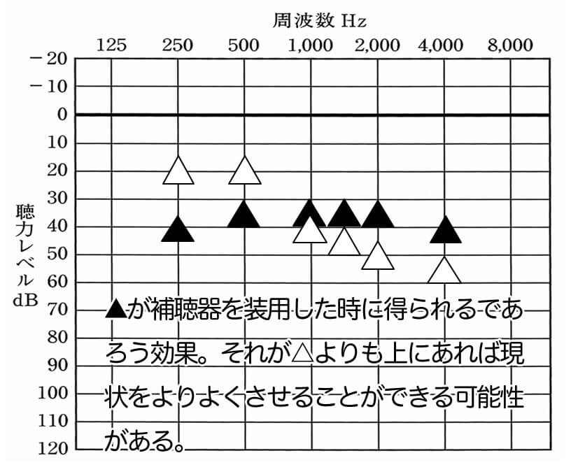 補聴器で改善できる数値は、限られている。それが、▲の位置になる。それよりも測定し、△の位置が下にあるものは、改善させやすい。特に重要なのは、500Hz、1000Hz、1500Hz、この部分が下がっていれば聞こえを改善させることが可能。
