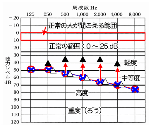 基本的に補聴器は、どこまで聞こえを改善させられるかで、基本の聞こえは、決まる。これは、性能とは、別の要素になる。