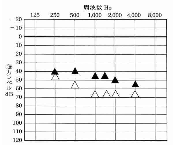 仮に調べてみたらこのような状態だった。その場合、どのように改善させたら良いだろうか?