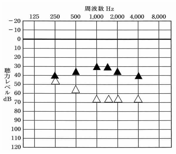 私の実際の状態。目標と同等か、それ以上にしている。それ以上にしていても大きすぎて辛いということがなければ、だいたい大丈夫。