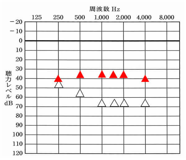 聴力から出した改善目標。この部分は、主に補聴器販売店側の仕事。