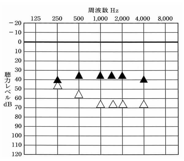 測定後、よりよくなっていればよし。ただ、基本的にこの数値は、このように綺麗な状態ではなく、少々、上下することが多い。