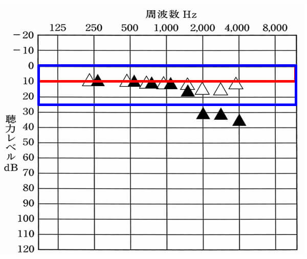 改めて数値をみてみよう。高域だけ、正常の範囲から出ているのがわかる。数値は、基準を理解すること、その数値が意味することを理解することが重要だ。