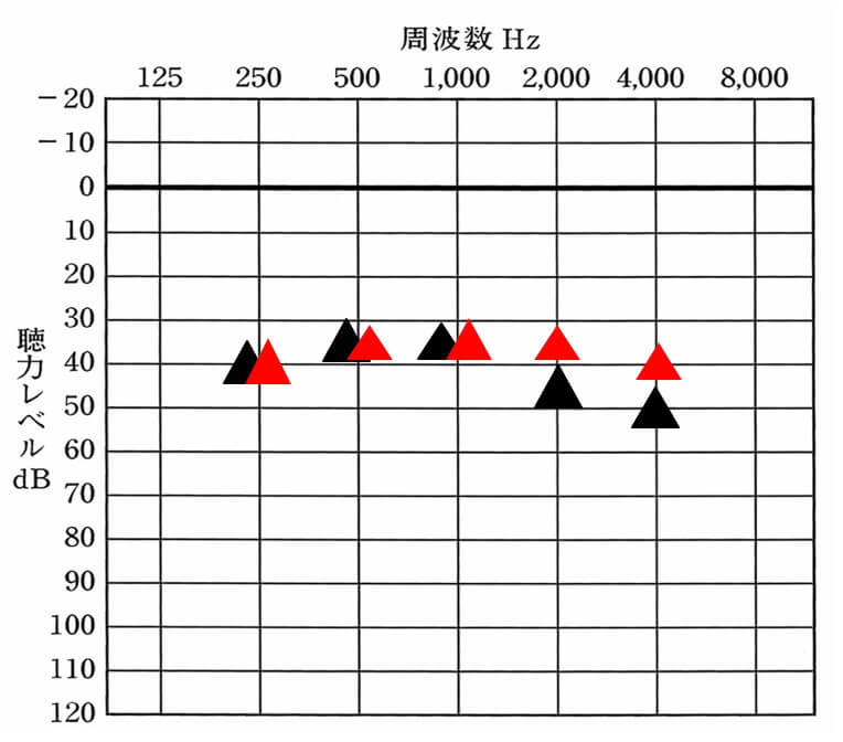 ▲が補聴器なしの状態。赤い▲が補聴器で目指す目標値だと設定。