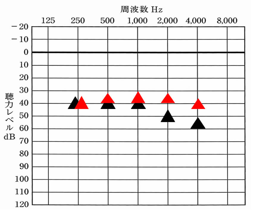 ▲が補聴器を装用して聞こえている値、赤い△が補聴器を装用して目指す聞こえのライン。補聴器は、自分の状況を可視化し、聴力から改善できるであろう目標を決め、そこまで改善を目指す。目標がないとどこまで聞こえればいいかわからないからだ。