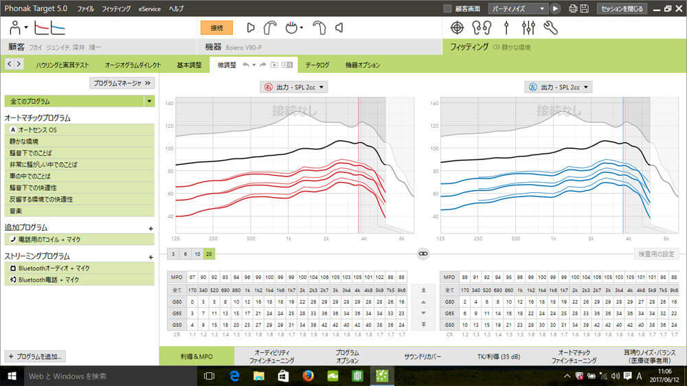補聴器の調整画面。調整というと、この部分をどう操作するか。ということを考えることが多い。