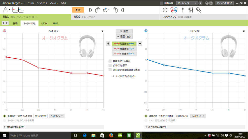 補聴器を調整する際は、フィッティングソフトを使用し、調整していく。その聴力を入れる際の画面が、こちら。