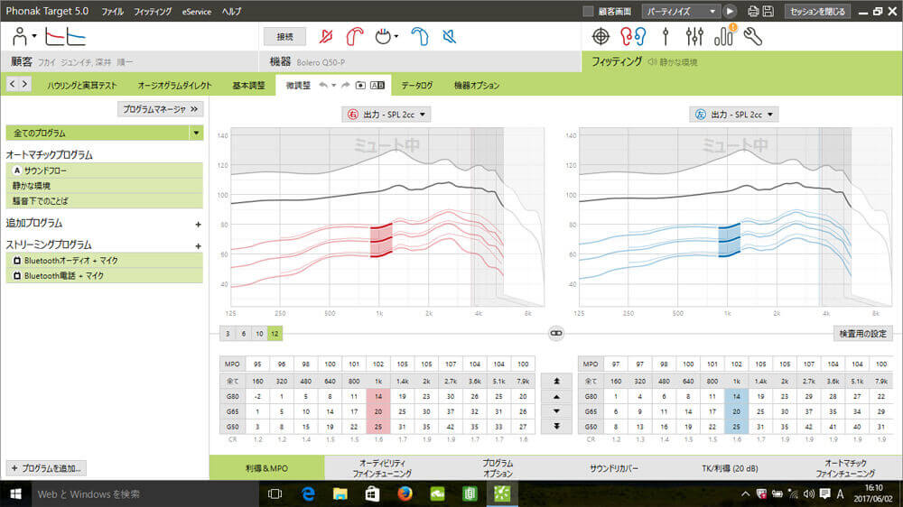 補聴器には、チャンネルというものがあり、それぞれどのくらい細かく分けて調整できるかの指数がある。それにより、足りない部分の周波数だけ補うということがしやすくなる。