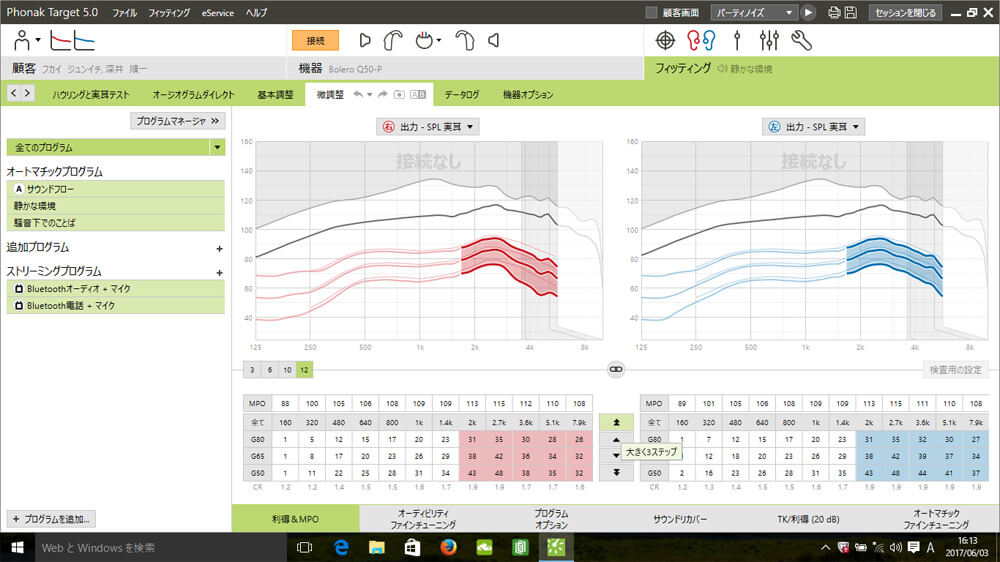 補聴器は、周波数ごとに調整できるようになっている。足りないところがわかれば、そこのところだけ増幅して補う。ということもできる。このように改善を行なっていく。