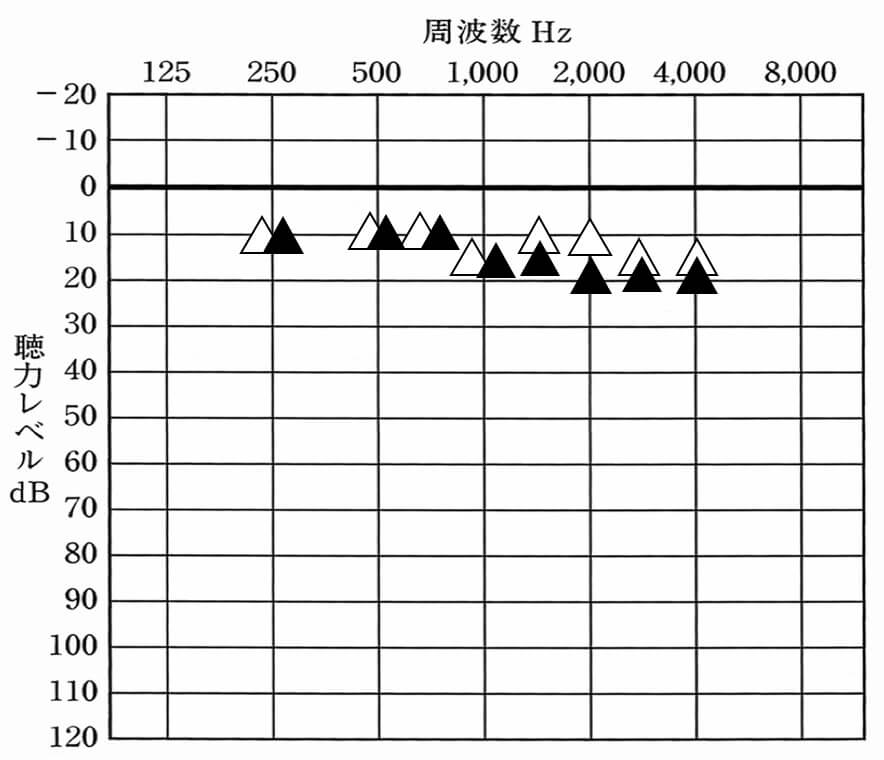 △が補聴器なし。▲が補聴器あり、できれば、▲は、このくらいまでで抑えられると良い。聞きにくさをどうも感じにくい傾向がある。