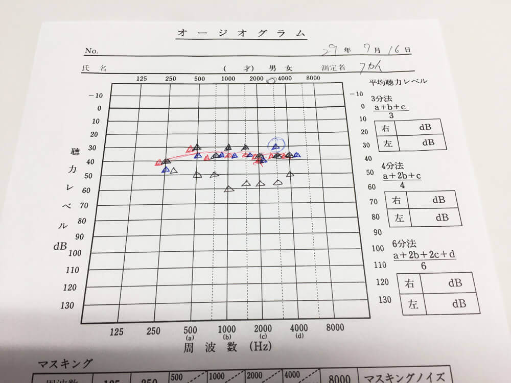 補聴器を使用した時の効果測定の一つ。こちらも見方がわかると補聴器使用時の状況がわかるため、非常に重要になる。