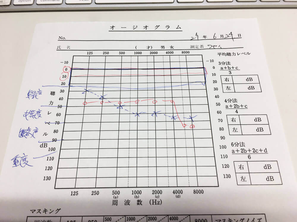 説明に使用した実際のもの。図の見方がわかるようになると自分の状況は非常に理解しやすくなる。