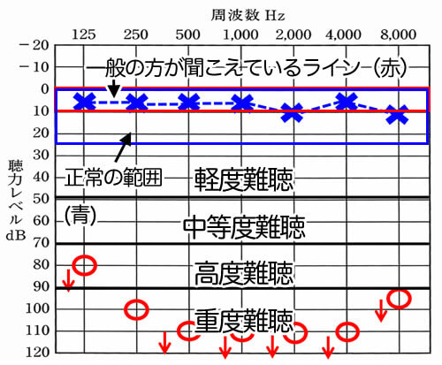 聴力図の数値の意味。おおよその見方がわかると、どのような状態なのかがわかるようになる。