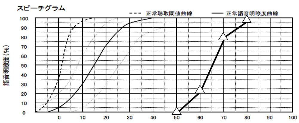 耳には、音を大きく入れるとどれだけ音声が理解できるのかを調べるものがある。その結果がこちら。私の場合、補聴器の適性は、非常にある状態だった。