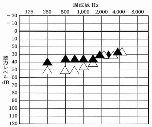 上記の聴力の場合における改善目標。低いところを補いつつ、高い音は、補聴器なしより、低くならないようにするのがポイント。これが難しい。