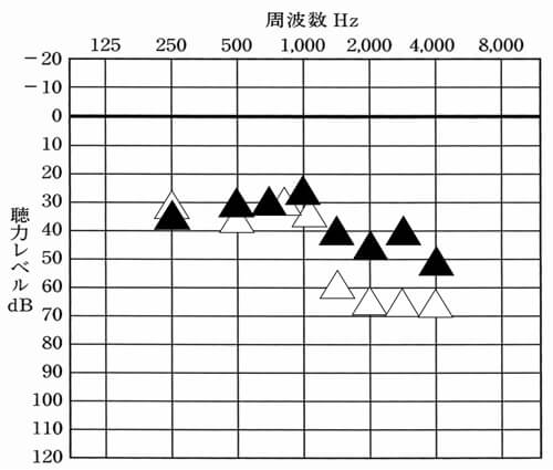 補聴器には、補聴器を使用した状態で、どのくらい聞こえているのかを調べる測定がある。それを使うことで、どのような聞こえなのか。どのくらい効果が出ているのかを判断することができる。