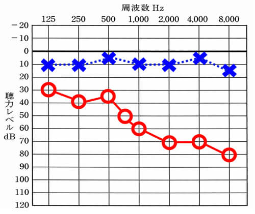 意外に見るパターン。明瞭度が低い場合は、高域が大きく低下しているケースをよく見る。
