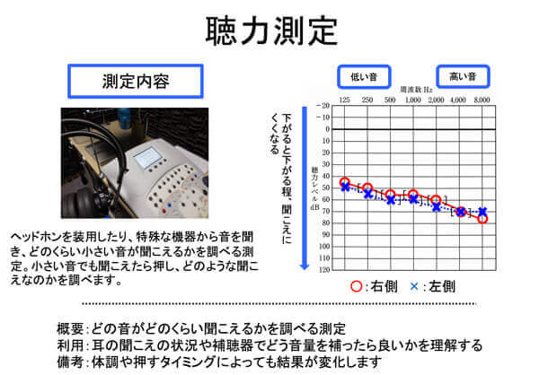 こちらは、もしかしたら受けた方も多いかもしれません。各音の大きさがどれだけの聞こえなのかを調べられる測定です。