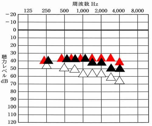 赤い△が補聴器を使って聞こえを改善すると良い数値。△が補聴器なし、▲が補聴器ありの状態。現状を調べ、自分の聴力から目指せると良い数値がわかると、現状を把握したり、自分の補聴器が合っているのか、そうでないかがわかるようになる。
