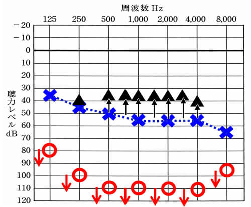 ▲は補聴器をつけた時の数値。この数値は、上に来ると来るほど、聞こえが良いことを表す。補聴器の場合、周波数別にこのような測定ができるようにもなっている。