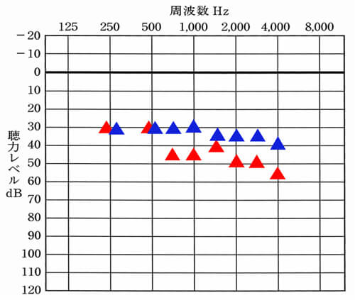 下がっている所の差が大きいと大きいほど、聞こえている側しか聞こえないような感覚になる。逆にいえば、左右の聞こえを確認する事で、ちゃんと両耳とも補えているのか。がわかるようになる。