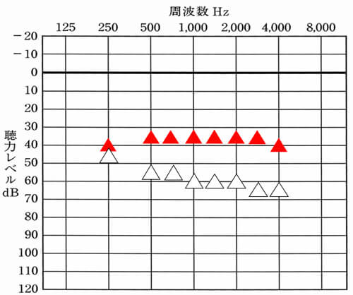 補聴器には、聴力別にある程度、どこまで聞こえると良いか。という改善の目標値がある。その部分まで改善させることが、聞こえを改善させる上で、最も重要な部分になる。