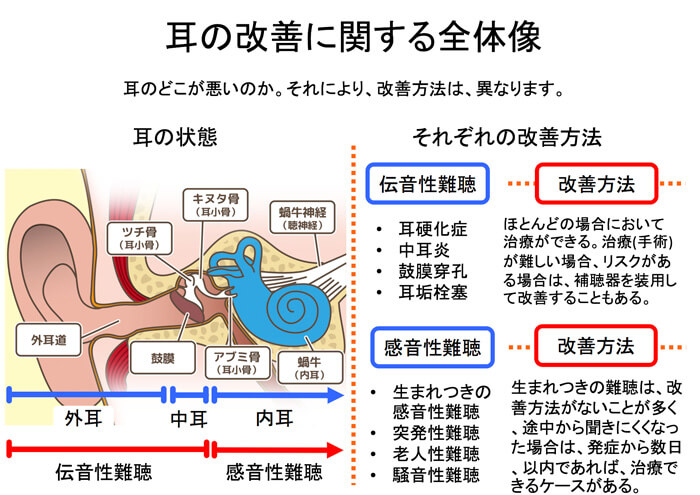 伝音性難聴は、改善する手段があることが多く、感音性難聴は、改善させられる病状も、方法も少ない。特に生まれつきの感音性難聴と老人性難聴は、改善方法がほぼ0になる。そのようなケースは、補聴器で聞こえにくさを改善させるのが大半になる。