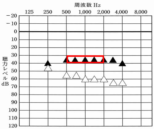 低い男性の声は、概ね500Hz、750Hz、あたりが関与し、女性の声は、1000〜2000Hzあたりが影響を受けやすい。実際には、250Hzも改善させられると良い傾向がある(低い男性の声)