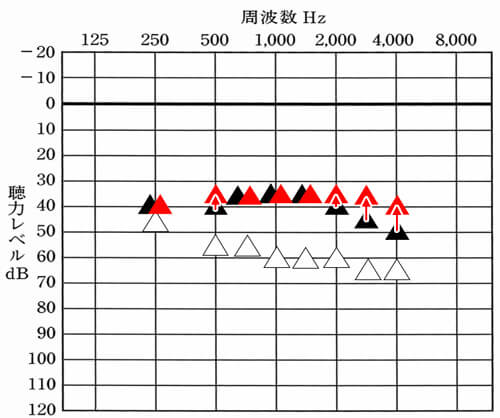 測定値だけだと、聞いた音の体感を無視した状態にしやすい。必ず体感も確認した上で、もう少し大きくしても良さそうなら、足りないところを重点的に大きくする事で、より聞きにくさを改善しやすくなる。