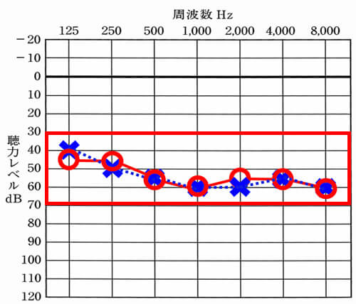今回の内容の対象となる聴力の方。主に赤い枠内に入っている方が対象。