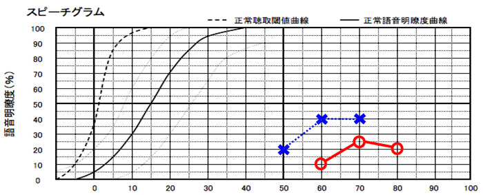両耳とも低い場合は、効果は薄くなる傾向はある。ただ、それでもわかることは増えるので、改善する見込みがあるのであれば、やってみるのも重要になる。
