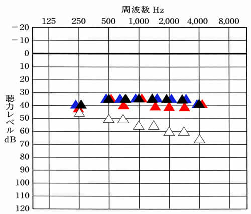 このように右だけ、左だけの数値が見れるようになると、どの部分は、バランスよく聞こえていて、どの部分が異なっているのか。目で確認することもできるようになる。目で確認できるようになれば、自ずと修正する部分もわかるようになり、バランスを整えやすくなる。