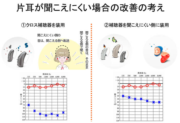片耳のみ難聴の場合に置ける考え。あくまでも例の一つだが、片耳のみ難聴の場合、耳の状況によって改善方法が変わり、かつ、特殊なケースが多いので、それを踏まえながら、改善方法を考えていく必要がある。