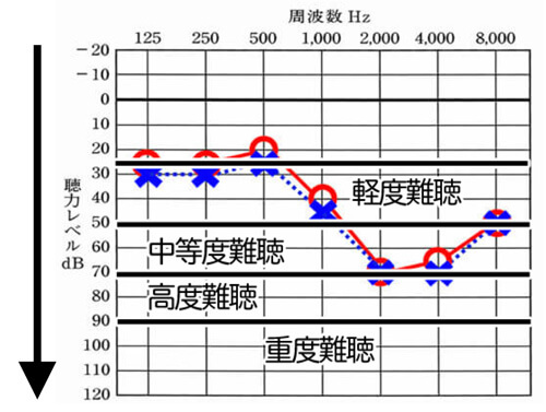 下がっている音のレベルごとに、聞きにくさのレベルがある。