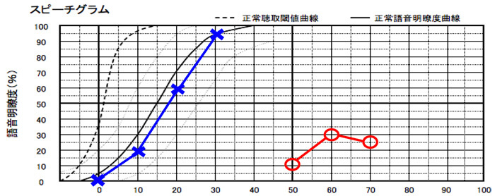 明瞭度が低かった例。右側が○、左側が×。縦軸が正解数を表しており、上に行くと上に行くほど、良い数値になります。横軸は、音の強さを表します。