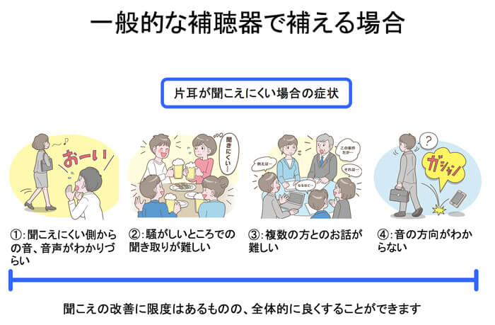 一般的な補聴器で補える場合は、両耳とも聞こえるようになることで、全体的に改善させることはできます。どうしても改善の限度は出てはしまうのですが、全体的に改善しやすいのが特徴です。