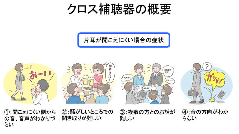 片耳のみ聞こえにくい方にヒアリングしてみますと、聞きにくさを感じている部分、不便な部分は、大抵、この4つに分類されることが多い。