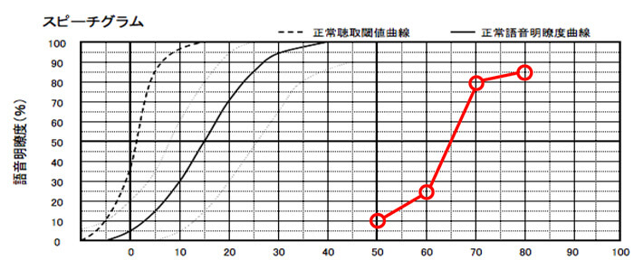縦のラインが、正解数になります。この数値は、上に行くと行くほど、音を大きくする事で、音声を理解しやすい耳であることがわかります。逆にあまり上がってこない場合は、音を大きくしても、理解度は上がりにくいことがわかります。