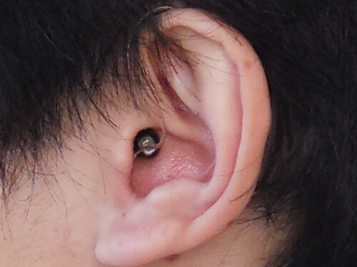 耳かけ形（よく使われるRIC（リック）タイプ）の補聴器の使用状態。