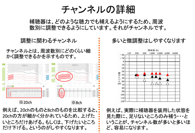 チャンネル(ch)とは、補聴器の調整に使われる機能で、それぞれの補聴器には、必ず、どのくらい細かく調整できるかが設定されている。8chと20chでは、細かさが異なる。これが活きるのは、調整する際で、改善していく際にどのくらい補聴器を装用して効果が出ているのかを調べた際に、足りない部分があった際に、細かく補正がしやすくなる。