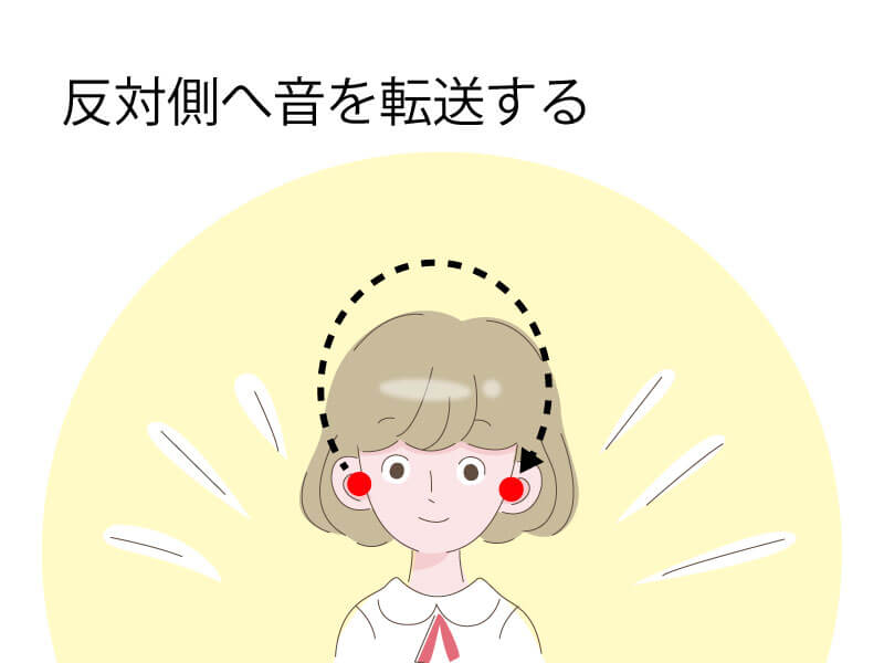 クロス補聴器は、聞こえない耳に来る音を聞こえる耳に送る補聴器