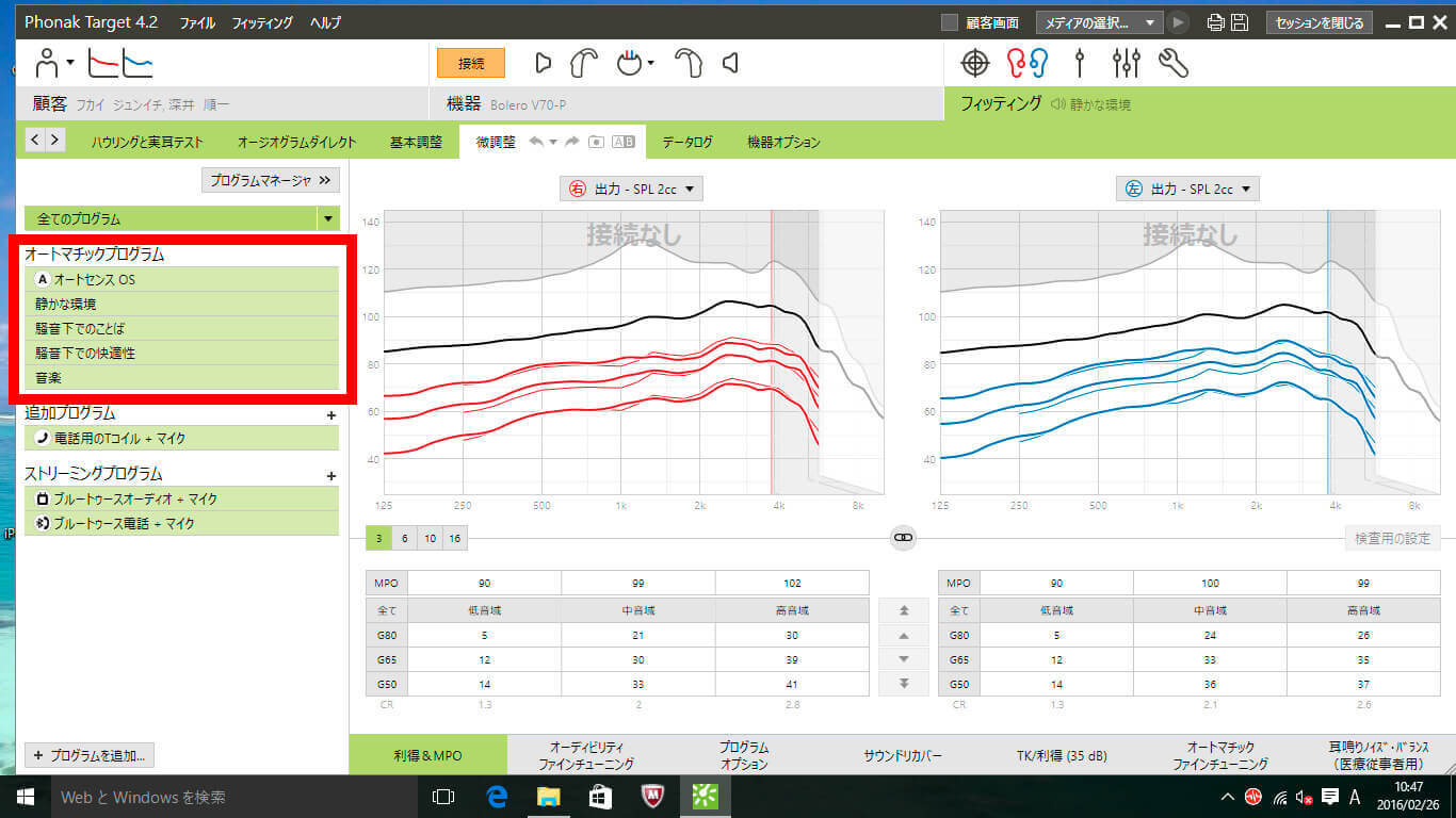 補聴器の調整画面、ご参考に