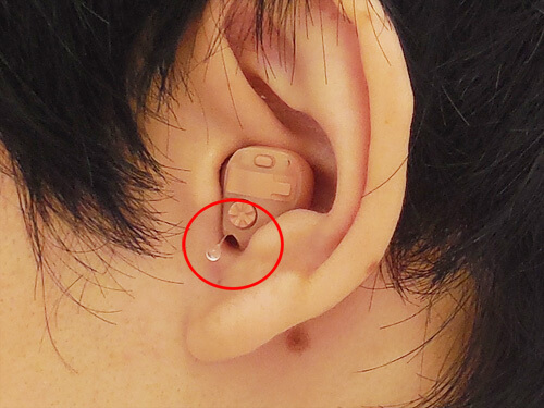 聞こえる耳側に補聴器を製作するタイプのイメージ（クロス仕様の場合）。補聴器の下の部分に大きなあなを空け、そこから音が入るようにする。