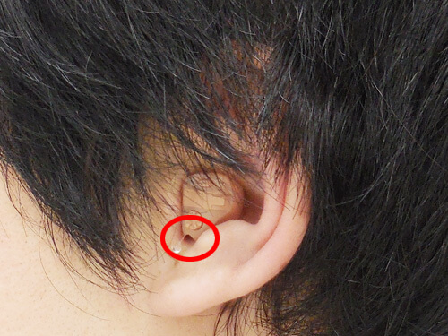 赤い丸の部分に空洞を設け、なるべく聞こえにくくならないようにするが、限度がある。そのため、少し補聴器側を聞きやすくさせて改善させる。