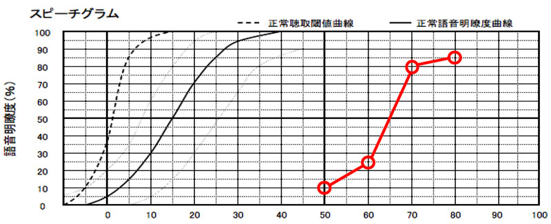 音を大きくして、言葉を聞かせる事で、正解率が上がっているケース。このような場合は、補聴器の効果も出やすくなります。